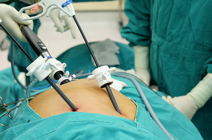 Basic Laparoscopic Surgery Tasks